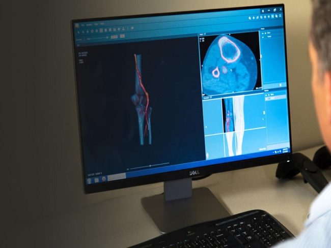 3D Systems Sells Medical Simulation Business to Surgical Science